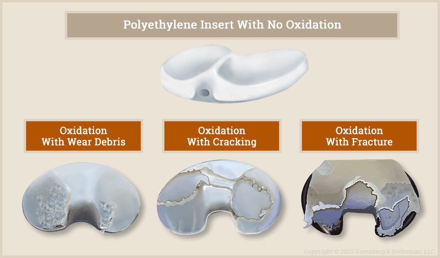 Exactech polyethylene insert oxidation
