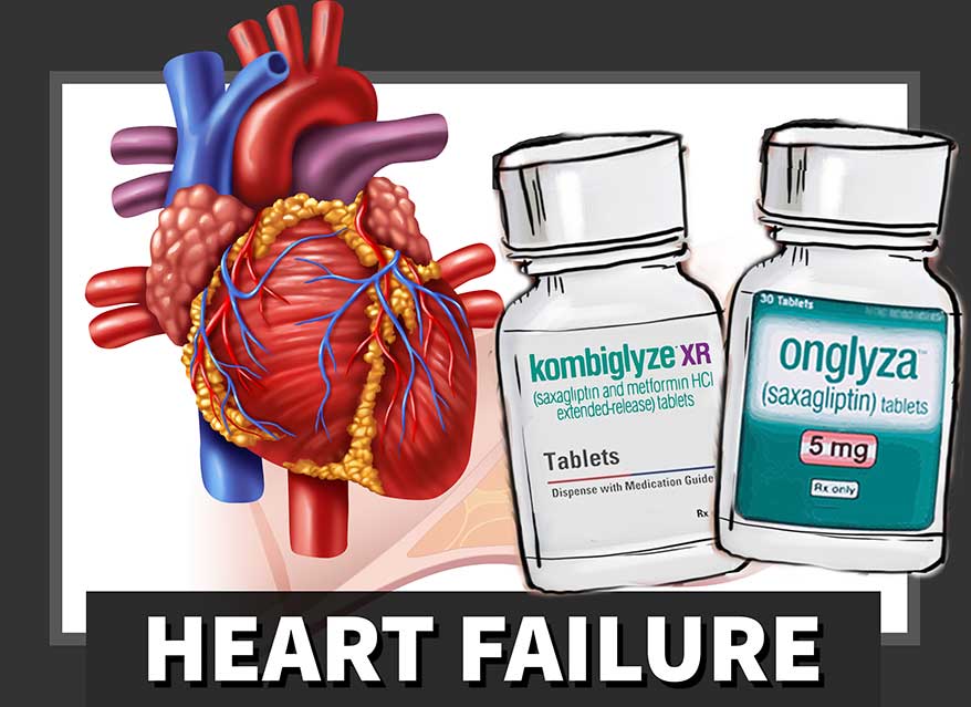 Onglyza and Heart Failure