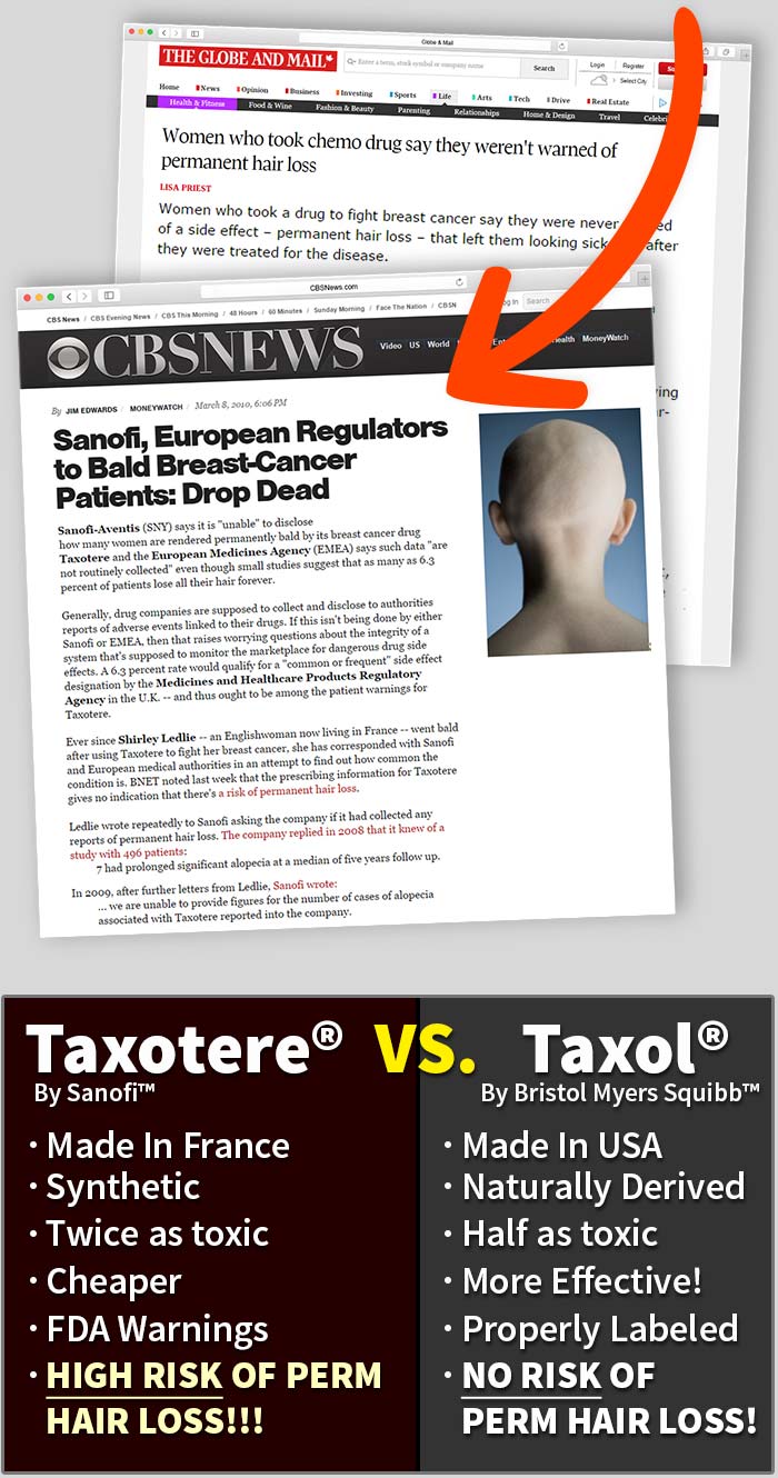 Taxotere Lawsuits For Permanent Hair Loss